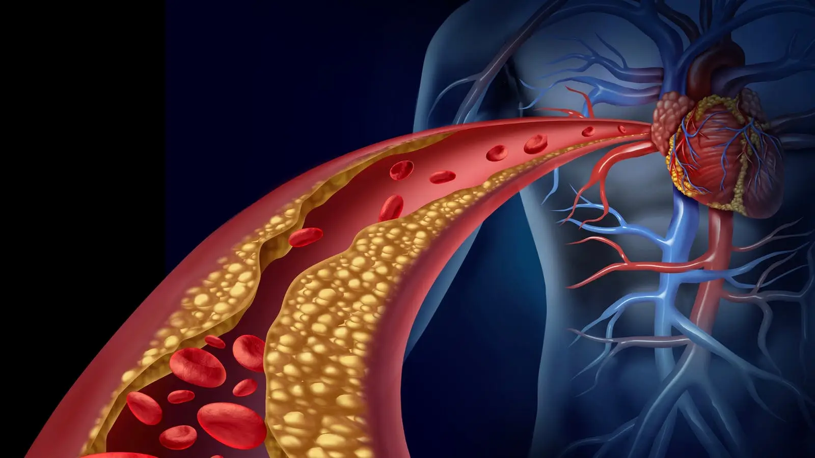 Infarto del miocardio: quali sono i principali fattori di rischio e come possiamo prevenirli?