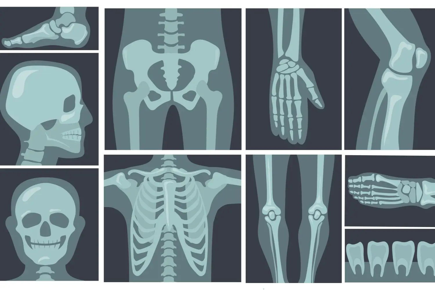 Midollo osseo stanco: i cinque cibi per rimetterlo in sesto secondo i medici