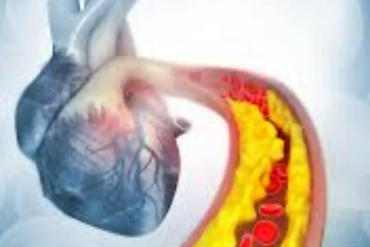Malattie cardiache: ecco le 5 cause più diffuse da monitorare