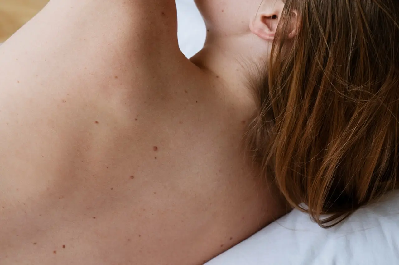 Stai per andare dal dermatologo? Ecco cosa devi assolutamente portare alla prima visita