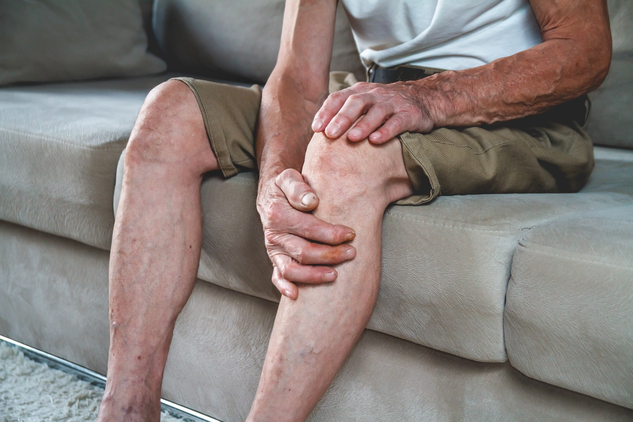 Soffri di osteoporosi? Ecco il tipo di collagene che rinforza davvero le tue ossa