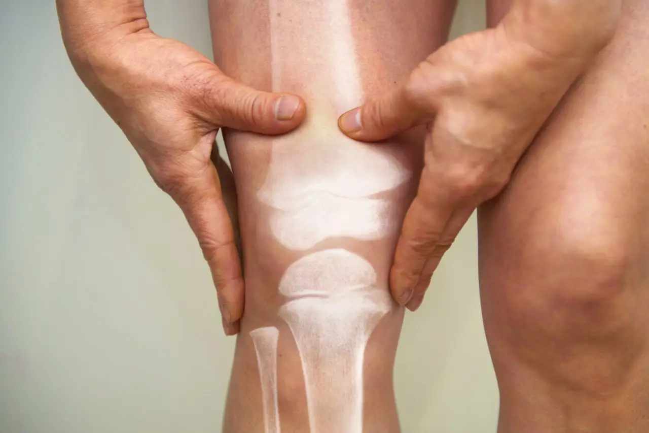 L’abitudine quotidiana che distrugge le tue articolazioni: ecco come prevenire artrite e artrosi